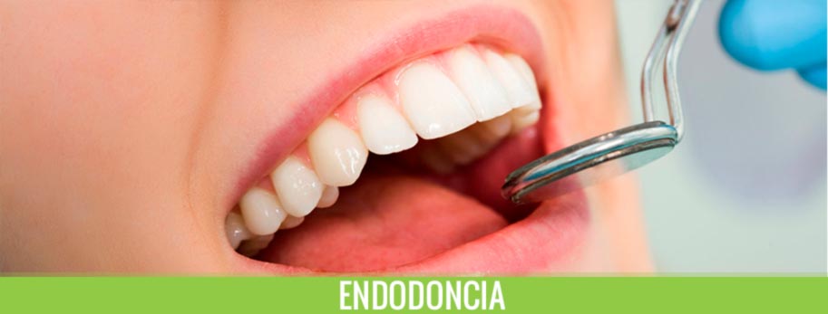 endodoncia.jpg